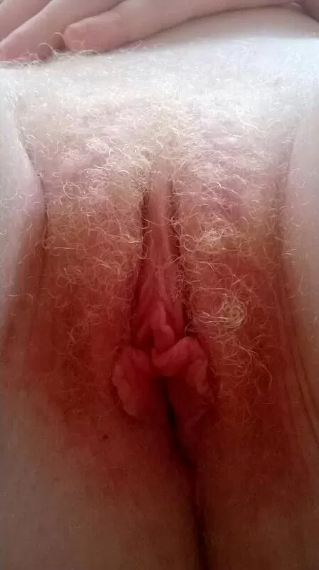 Hairy Albino Pussy Pics